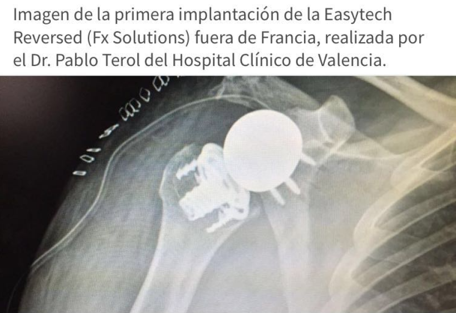 Implantación Easytech Reversed