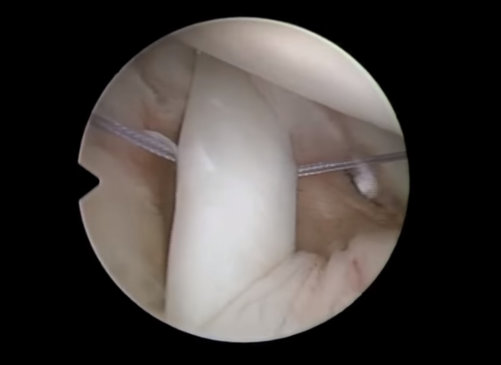 imagen video