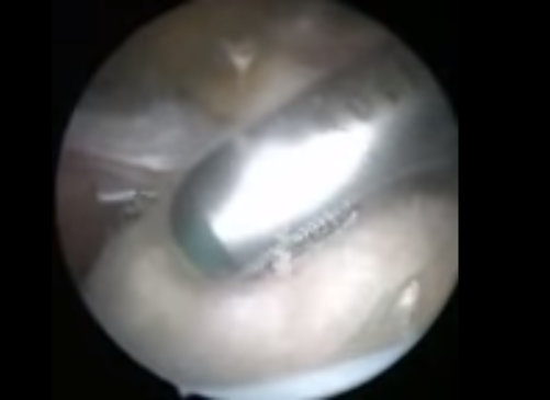 imagen video