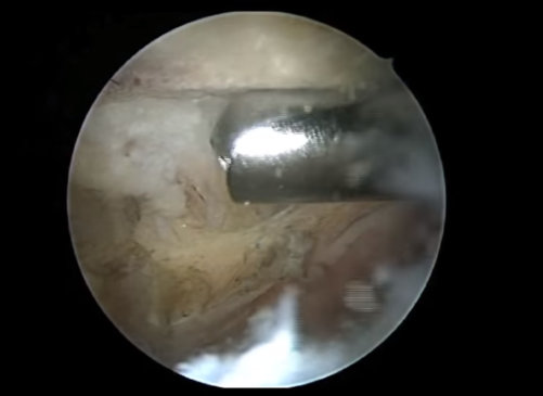 imagen video