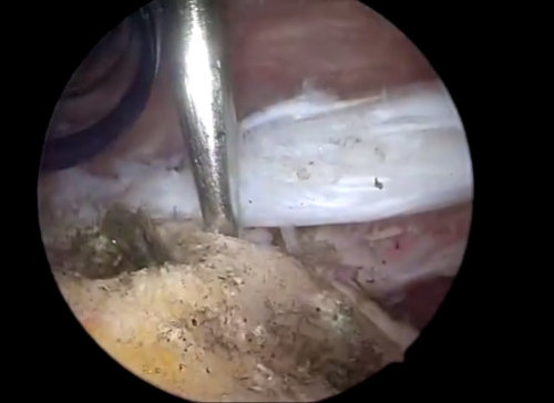 imagen video